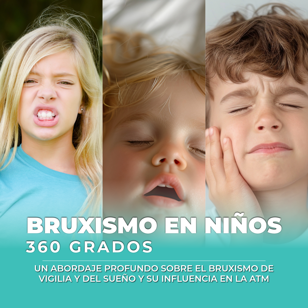 Bruxismo en niños 360 grados