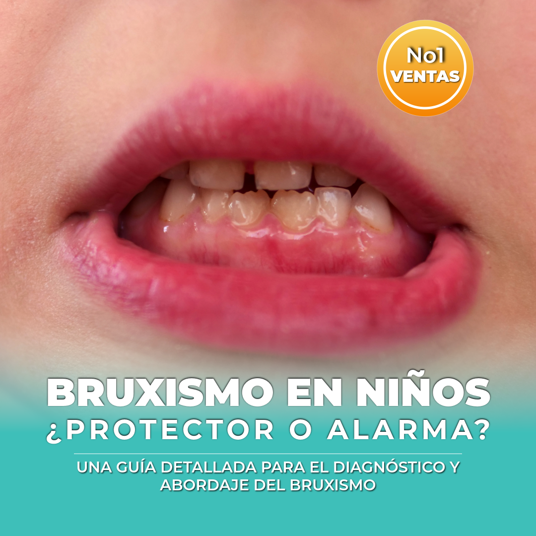 Bruxismo en niños ¿Protector o Alarma?