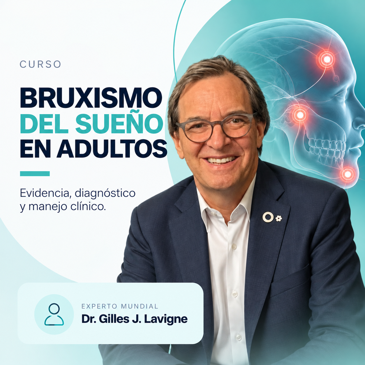 Bruxismo del Sueño en Adultos