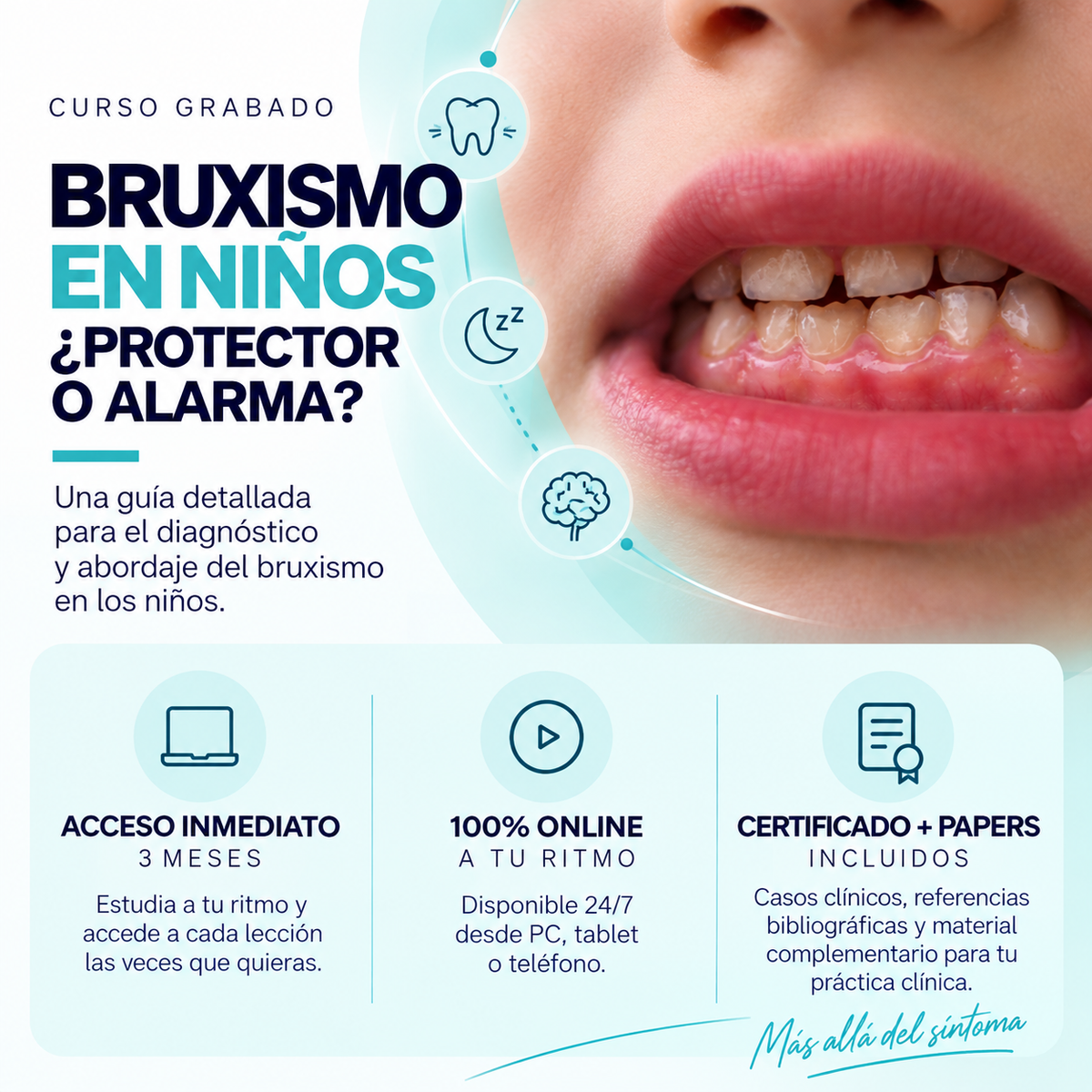 Curso Bruxismo en niños: ¿Protector o Alarma?