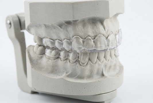 Placa oclusal transparente colocada sobre los dientes superiores de un modelo dental de yeso.