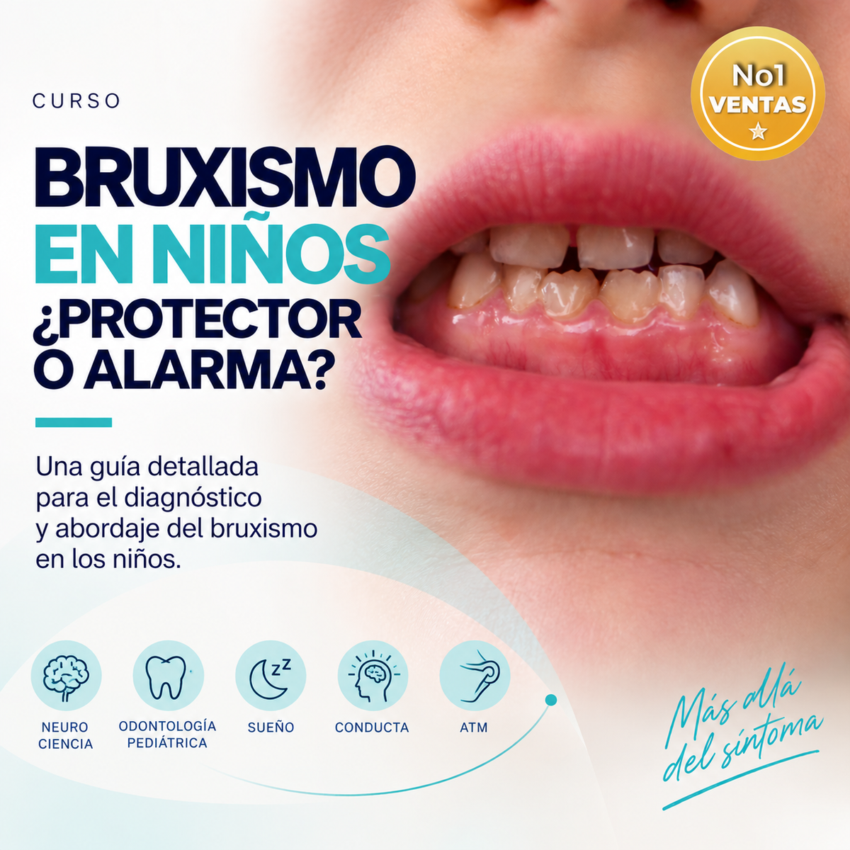 Bruxism in Children: Protector or Alarm?