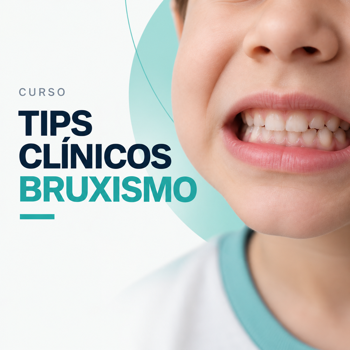 Clinical Tips on Bruxism