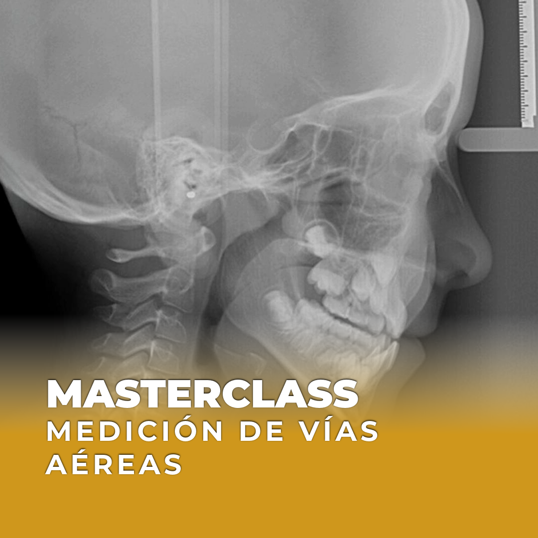 MASTERCLASS Trazado de Vías Aéreas
