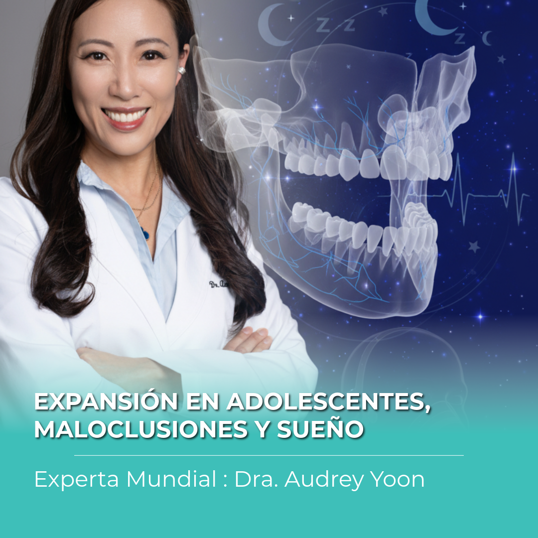 Expansión en adolescentes, manejo de maloclusiones y sueño