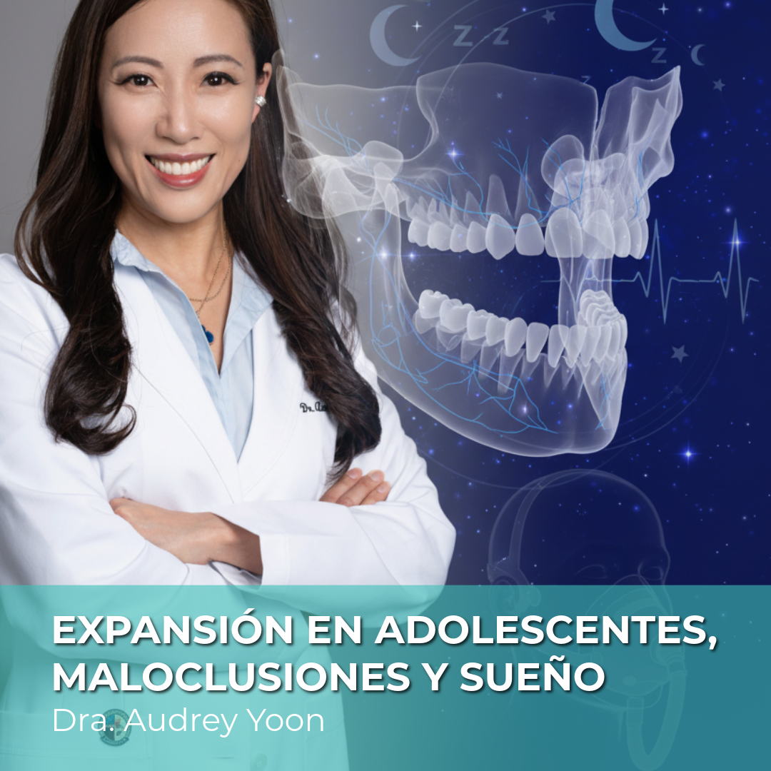 Expansión en adolescentes, manejo de maloclusiones y sueño
